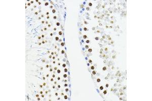 Immunohistochemistry of paraffin-embedded rat testis using ZEB1 antibody (ABIN6129933, ABIN6150422, ABIN6150423 and ABIN6221237) at dilution of 1:200 (40x lens).