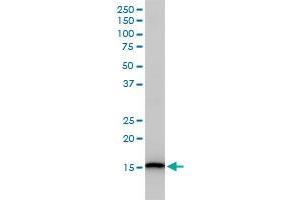 UBE2D3 monoclonal antibody (M01), clone 4C1-1E3 Western Blot analysis of UBE2D3 expression in Jurkat .
