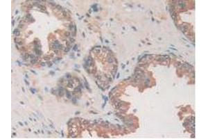 Figure. (USP7 anticorps  (AA 54-507))