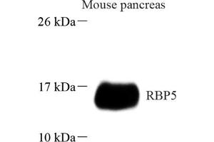 Western blot analysis of RBP5 (ABIN7075410) at dilution of 1: 1000 (Retinol Binding Protein 5 anticorps)