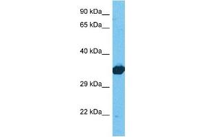 Host:  Rabbit  Target Name:  LDHB  Sample Tissue:  Human 293T Whole Cell  Antibody Dilution:  1ug/ml