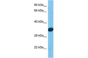 Host:  Rabbit  Target Name:  LDHB  Sample Tissue:  Human 293T Whole Cell  Antibody Dilution:  1ug/ml (LDHB anticorps  (C-Term))