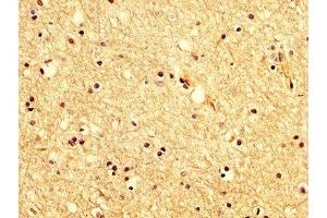 IHC image of ABIN7175618 diluted at 1:200 and staining in paraffin-embedded human brain tissue performed on a Leica BondTM system. (KCNAB1 anticorps  (AA 287-401))