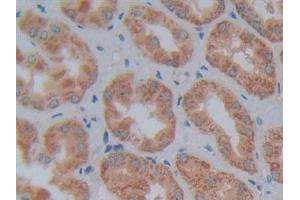 Detection of NT5C3 in Human Kidney Tissue using Polyclonal Antibody to 5'-Nucleotidase, Cytosolic III (NT5C3)