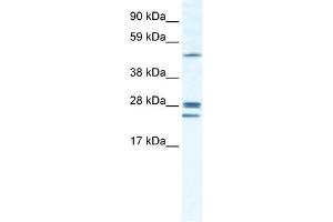 WB Suggested Anti-GJB2 Antibody Titration:  1. (GJB2 anticorps  (Middle Region))