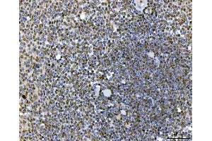 IHC analysis of SAP130 using anti-SAP130 antibody (ABIN7601247). (SAP130 anticorps  (AA 309-913))