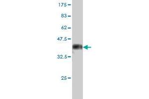 Western Blot detection against Immunogen (37.