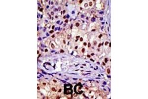 anti-RAD23 Homolog A (RAD23A) (AA 303-333), (C-Term) antibody