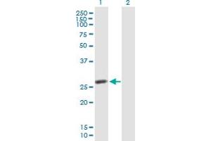 Western Blot analysis of IDI2 expression in transfected 293T cell line by IDI2 MaxPab polyclonal antibody. (IPP Isomerase 2 anticorps  (AA 1-227))