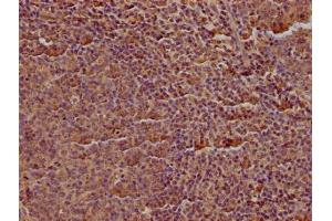 IHC image of ABIN7147134 diluted at 1:100 and staining in paraffin-embedded human tonsil tissue performed on a Leica BondTM system.