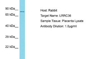 Host: Rabbit Target Name: LRRC36 Sample Type: Placenta lysates Antibody Dilution: 1. (LRRC36 anticorps  (N-Term))