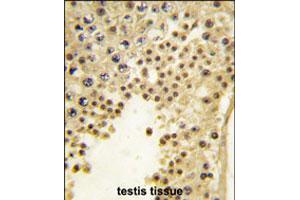 Formalin-fixed and paraffin-embedded human testis tissue reacted with FBXL11 polyclonal antibody  , which was peroxidase-conjugated to the secondary antibody, followed by DAB staining. (KDM2A anticorps  (Internal Region))