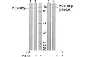 Image no. 1 for anti-Protein Kinase D1 (PRKD1) (Ser738) antibody (ABIN197312) (PKC mu anticorps  (Ser738))