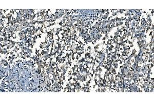 IHC analysis of CDC45L using anti-CDC45L antibody (ABIN7600230). (CDC45 anticorps  (AA 166-431))