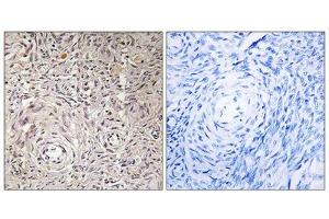Immunohistochemistry analysis of paraffin-embedded human ovary tissue using GCNT7 antibody.