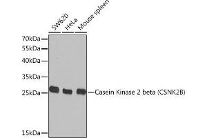 Western blot analysis of extracts of various cell lines, using Casein Kinase 2 beta (Casein Kinase 2 beta (CSNK2B)) Rabbit pAb  at 1:1000 dilution. (CSNK2B anticorps  (AA 1-215))