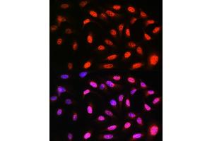 Immunofluorescence analysis of U-2 OS cells using VCP Rabbit mAb (ABIN7271284) at dilution of 1:100 (40x lens).