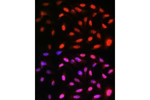 Immunofluorescence analysis of U-2 OS cells using VCP Rabbit mAb (ABIN7271284) at dilution of 1:100 (40x lens). (VCP anticorps)