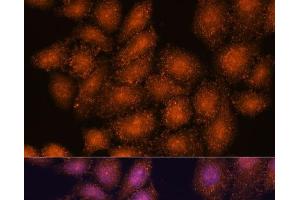 Immunofluorescence analysis of HeLa cells using SMYD3 Polyclonal Antibody at dilution of 1:100. (SMYD3 anticorps)