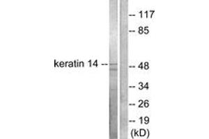 Western blot analysis of extracts from NIH-3T3 cells, using Keratin 14 Antibody.