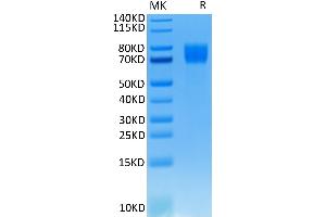 Human FGFR1 alpha (IIIc) on Tris-Bis PAGE under reduced conditions.