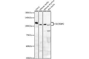 Western blot analysis of extracts of various cell lines, using SECISBP2 antibody (ABIN6128699, ABIN6147497, ABIN6147498 and ABIN6222461) at 1:500 dilution. (SECISBP2 anticorps  (AA 585-854))