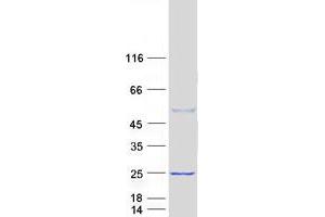Validation with Western Blot