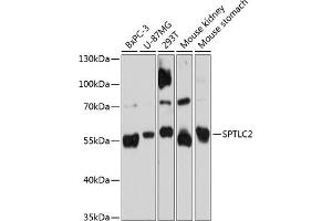 Western blot analysis of extracts of various cell lines, using SPTLC2 Antibody (ABIN6132682, ABIN6148411, ABIN6148412 and ABIN6215412) at 1:3000 dilution. (SPTLC2 anticorps  (AA 423-562))