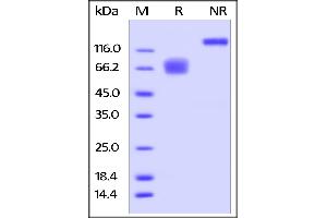 Human CD58, Fc Tag on  under reducing (R) and ing (NR) conditions.