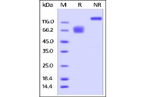 Human CD58, Fc Tag on  under reducing (R) and ing (NR) conditions. (CD58 Protein (CD58) (AA 29-215) (Fc Tag))