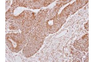 anti-Leucine Rich Repeat Containing 1 (LRRC1) (AA 265-524) antibody