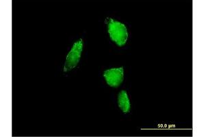 Immunofluorescence of purified MaxPab antibody to PSMA6 on HeLa cell. (PSMA6 anticorps  (AA 1-246))
