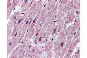 Immunohistochemistry (IHC) image for anti-Spinster Homolog 2 (SPNS2) (N-Term) antibody (ABIN2786494)