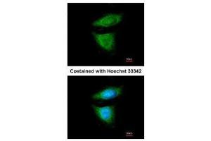 ICC/IF Image Immunofluorescence analysis of methanol-fixed HeLa, using DYNC1I2, antibody at 1:200 dilution. (DYNC1I2 anticorps)