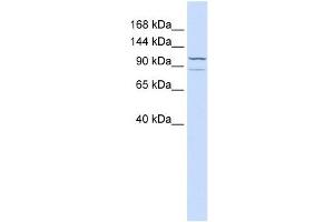 ADCY6 antibody used at 1 ug/ml to detect target protein. (ADCY6 anticorps  (C-Term))