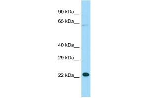 WB Suggested Anti-MOSPD1 Antibody Titration: 1. (MOSPD1 anticorps  (N-Term))