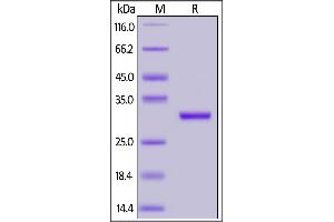 SARS-CoV-2 NSP7&NSP8, His Tag on SDS-PAGE under reducing (R) condition. (SARS-CoV-2 NSP7, NSP8 protein (His tag))
