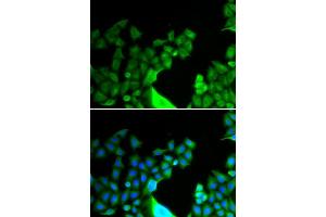 Immunofluorescence analysis of HeLa cells using BCL2L14 antibody (ABIN5973873). (BCL2L14 anticorps)