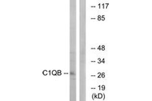 Western blot analysis of extracts from Jurkat cells, using C1QB Antibody.