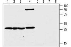 Western blot analysis of human colorectal adenocarcinoma HT-29 (lanes 1 and 5), transplantable human carcinoma cell line T-84 (lanes 2 and 6), human pancreatic carcinoma PANC-1 (lanes 3 and 7) and rat kidney (lanes 4 and 8) lysates: - 1-4. (CLIC1 anticorps  (C-Term, Intracellular))