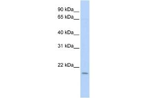 WB Suggested Anti-POLE3 Antibody Titration: 0. (POLE3 anticorps  (N-Term))