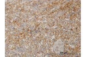 anti-Zyxin (ZYX) (AA 1-572) antibody