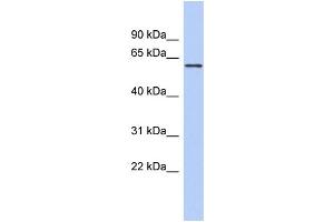 WB Suggested Anti-PDE4B Antibody Titration: 0. (PDE4B anticorps  (Middle Region))