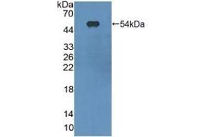 Detection of Recombinant ITGaX, Mouse using Polyclonal Antibody to Integrin Alpha X (CD11c)