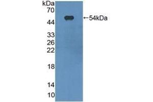 Detection of Recombinant ITGaX, Mouse using Polyclonal Antibody to Integrin Alpha X (CD11c) (CD11c anticorps  (AA 907-1115))
