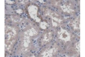Detection of DPPA3 in Human Kidney Tissue using Polyclonal Antibody to Developmental Pluripotency Associated Protein 3 (DPPA3)