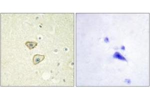 Immunohistochemistry (IHC) image for anti-Epidermal Growth Factor Receptor (EGFR) (AA 986-1035) antibody (ABIN2888655) (EGFR anticorps  (AA 986-1035))
