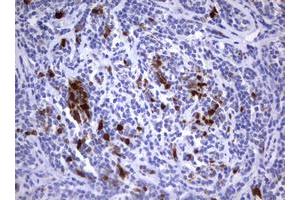 Image no. 1 for anti-Thymidylate Synthetase (TYMS) antibody (ABIN1501589)