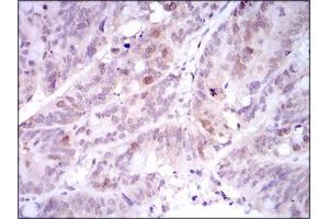 Image no. 1 for anti-Polo-Like Kinase 1 (PLK1) antibody (ABIN1500277) (PLK1 anticorps)