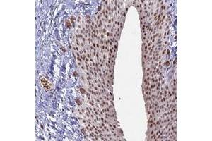 Immunohistochemical staining of human urinary bladder with MFAP1 polyclonal antibody  shows moderate nuclear positivity in urothelial cells at 1:2500-1:5000 dilution. (MFAP1 anticorps)